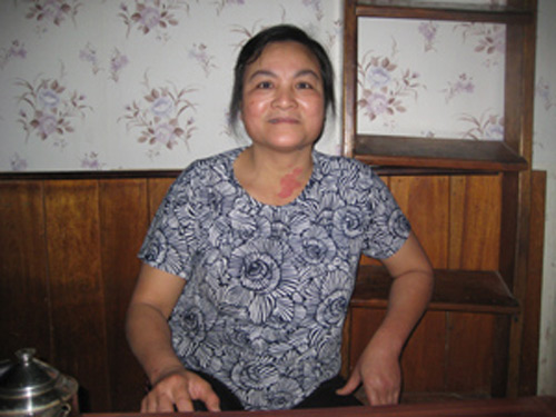 vo su thieu lam