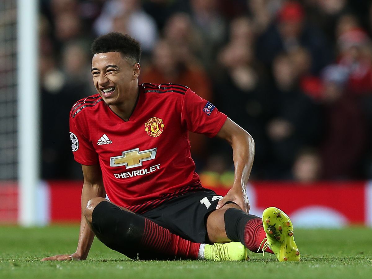 Solskjaer, Martial, Lingard, chấn thương MU, Martial chấn thương, MU, tin Man United, tin bong da, FA Cup