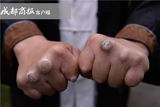 từ hiểu đông, từ hiểu đông là ai, tu hieu dong vs la cuong, tu hieu dong vs nguy loi, từ hiểu đông điền dã