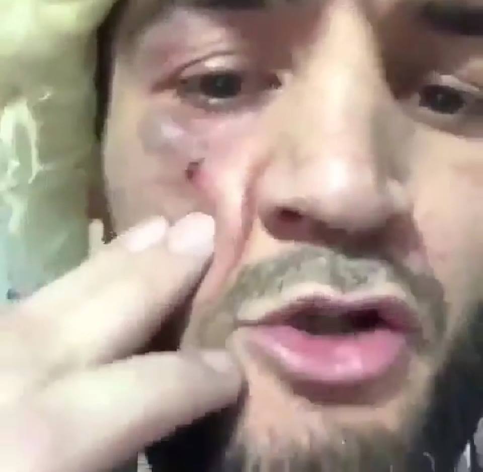 conor không kiện đồng đội khabib, conor bỏ qua vụ việc tại ufc 229, ufc 229 conor,