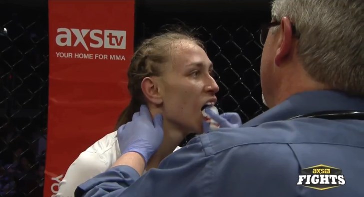 mma, nữ võ sĩ vỡ hàm, võ sĩ vỡ hàm,