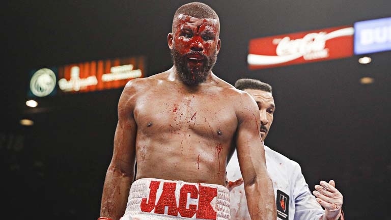 boxing, chấn thương, rách trán, húc đầu, chấn thương boxing,
