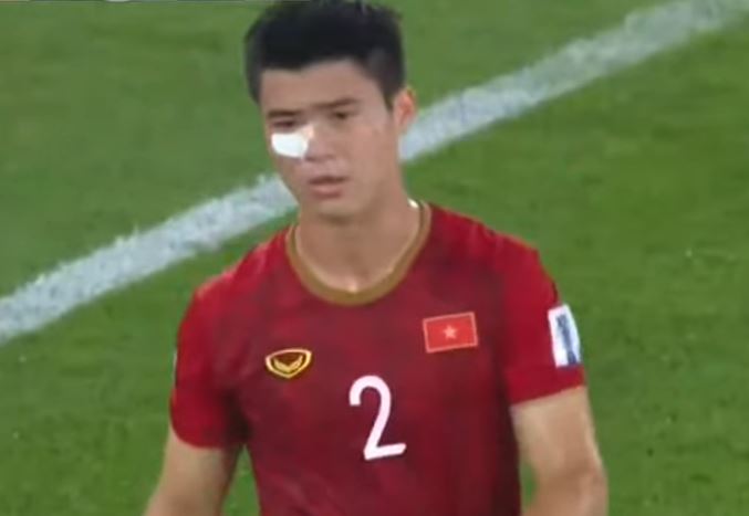 duy manh 2