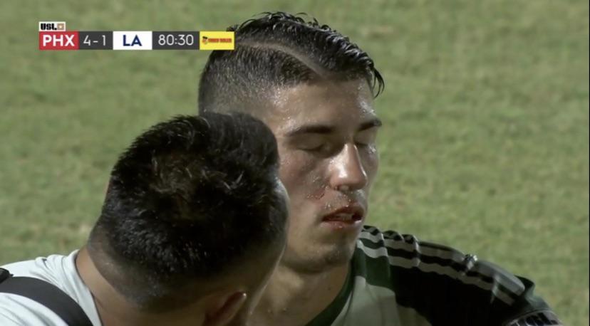 pháo sáng, hooligan, cđv ném pháo sáng, cđv tấn công cầu thủ, cđv ném bia, cđv ném vật thể lạ