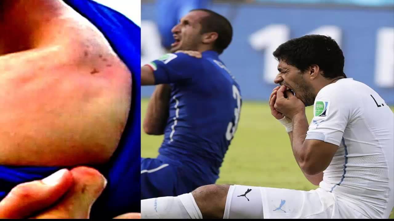Chiellini, Suarez, Italia, Ý, Uruguay, World Cup, World Cup 2014