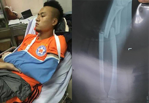 buc anh chup 3 am anh va den dui nhat bong da Viet Nam